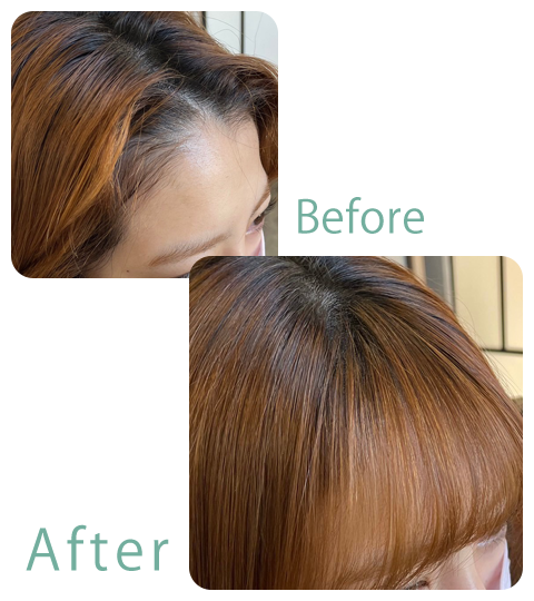 前髪縮毛矯正